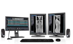 Digitalizador de imagens radiológicas