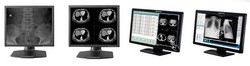 Monitor radiologia digital